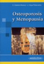 Osteoporosis y Menopausia