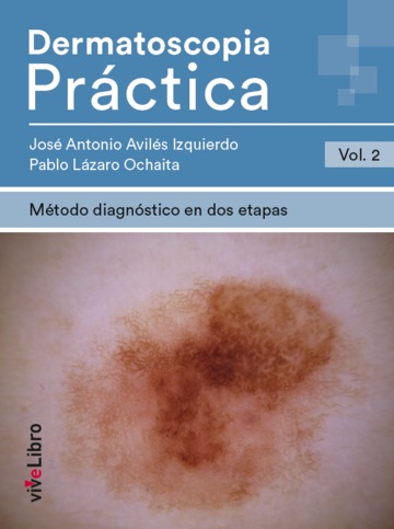 Dermatoscopia Prctica. Vol. 2: Mtodo diagnstico en dos etapas