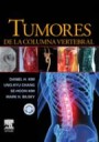 Tumores de la columna vertebral + cd-rom?Manual de tratamiento quirrgico de los tumores de la mdula espinal y el raquis, que i
