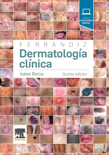 Ferrndiz. Dermatologa clnica (5 ed.)