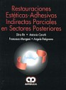 Restauraciones Estticas - Adhesivas Indirectas Parciales en Sectores Posteriores